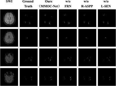 Construction of a Medical Micro-Object Cascade Network for Automated Segmentation of Cerebral Microbleeds in Susceptibility Weighted Imaging